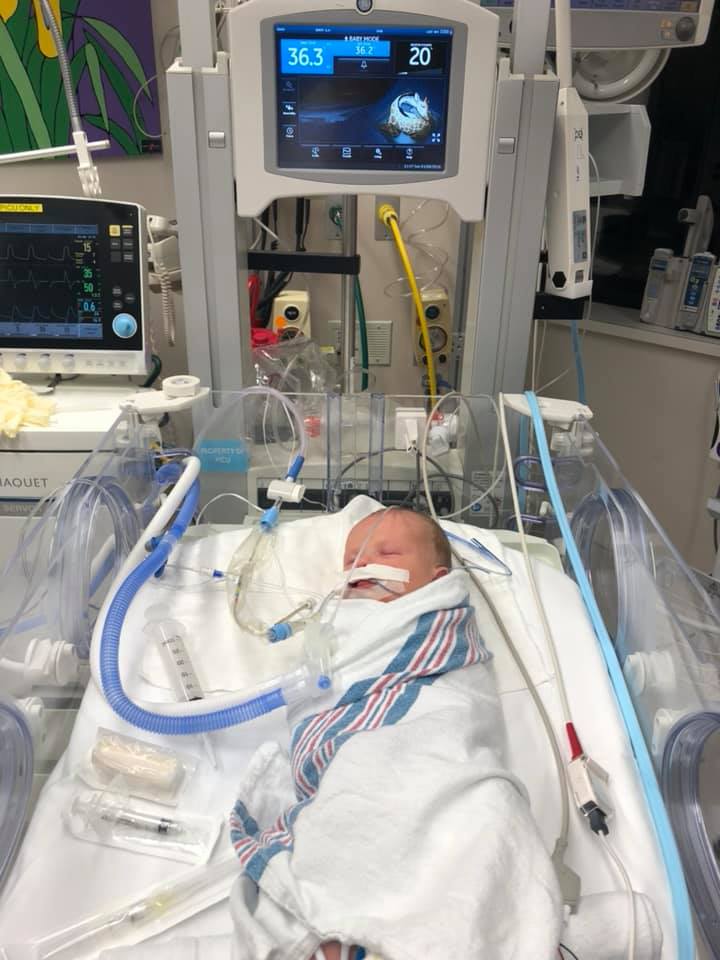 Newborn hospitalized with RSV
